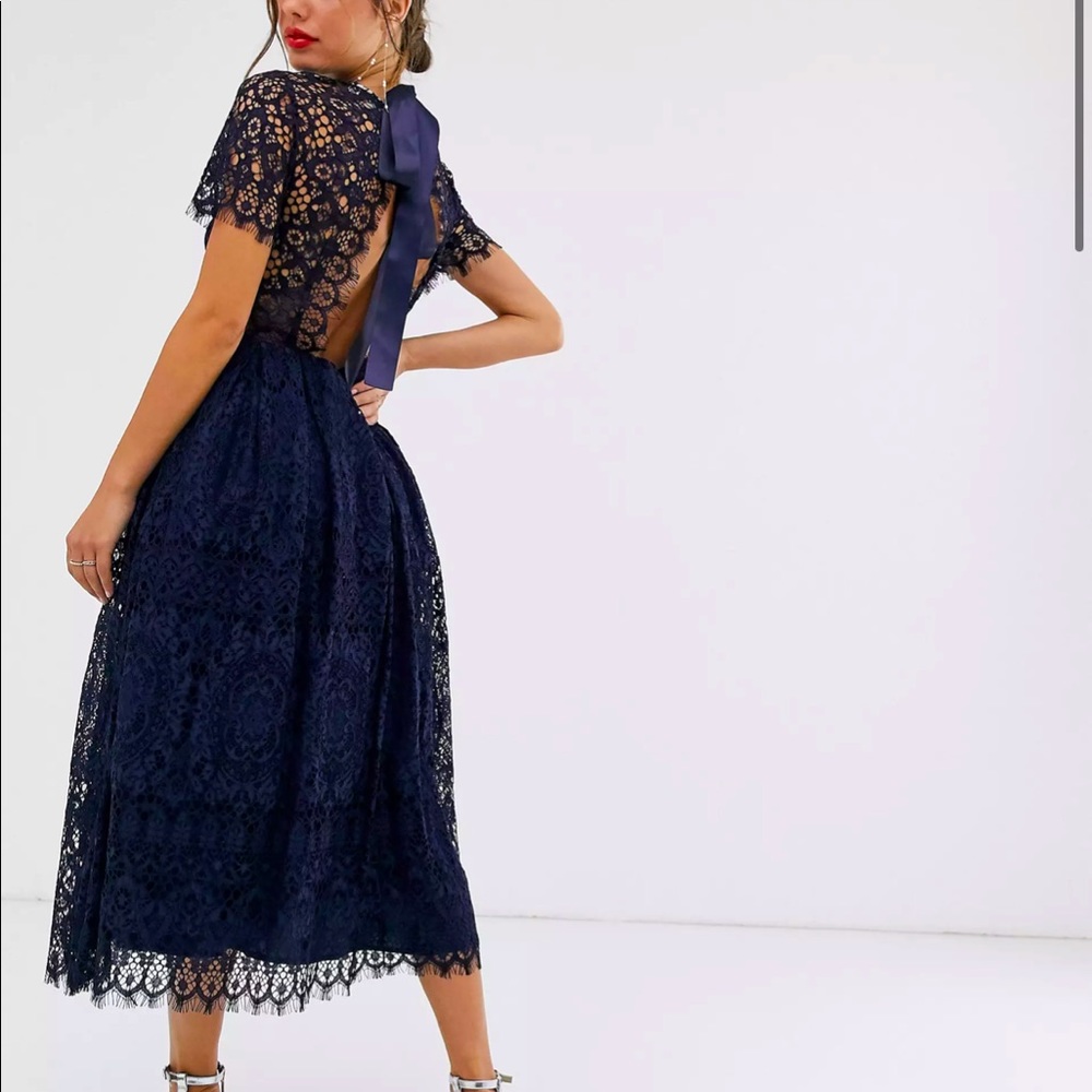 ASOS | Lace Midi Dress with Ribbon Tie and Open Back